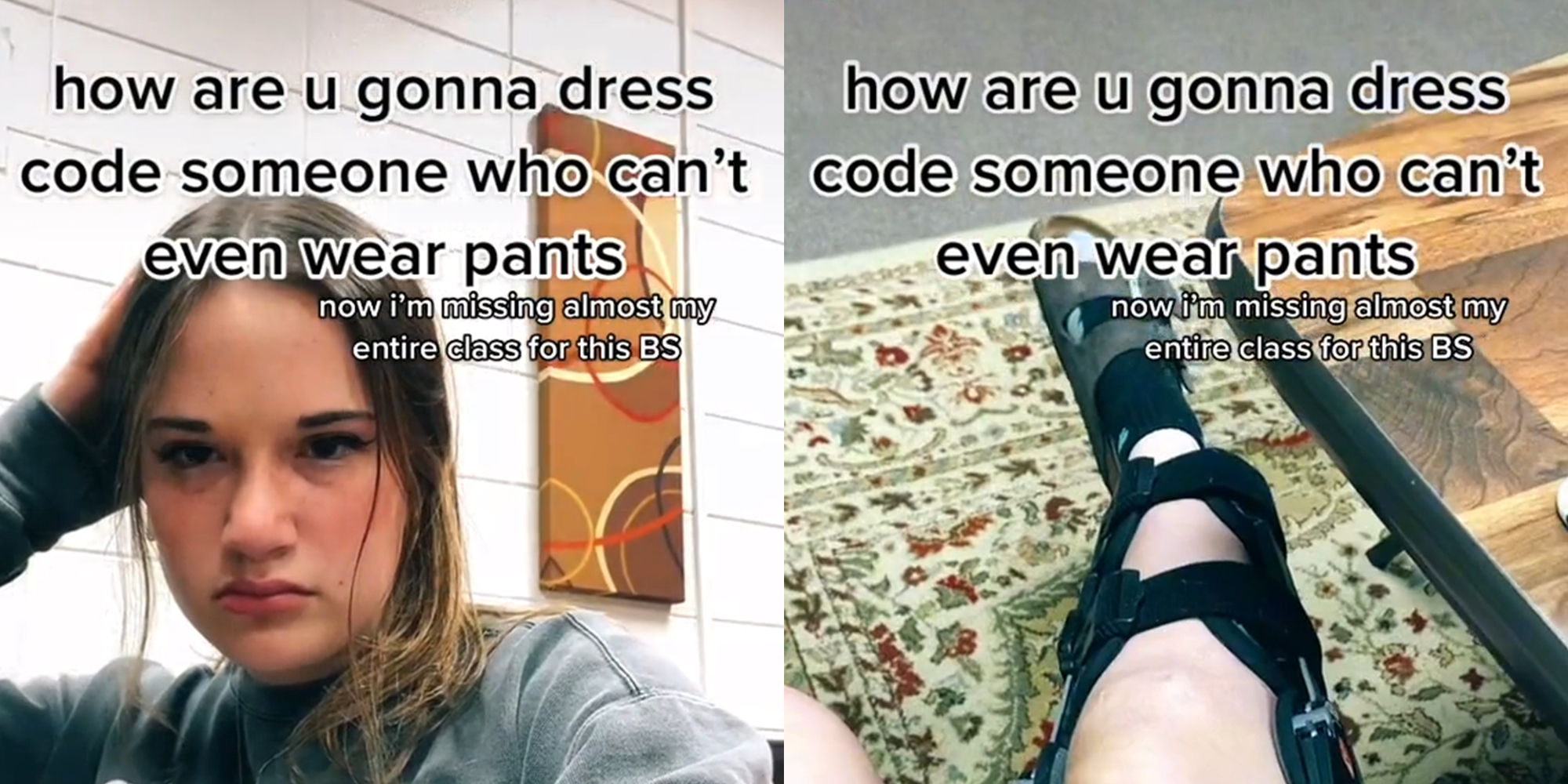 Irritated young woman (l) leg in a brace (r) both with caption "how are u gonna dress code someone who can't even wear pants? now i'm missing almost my entire class for this BS"