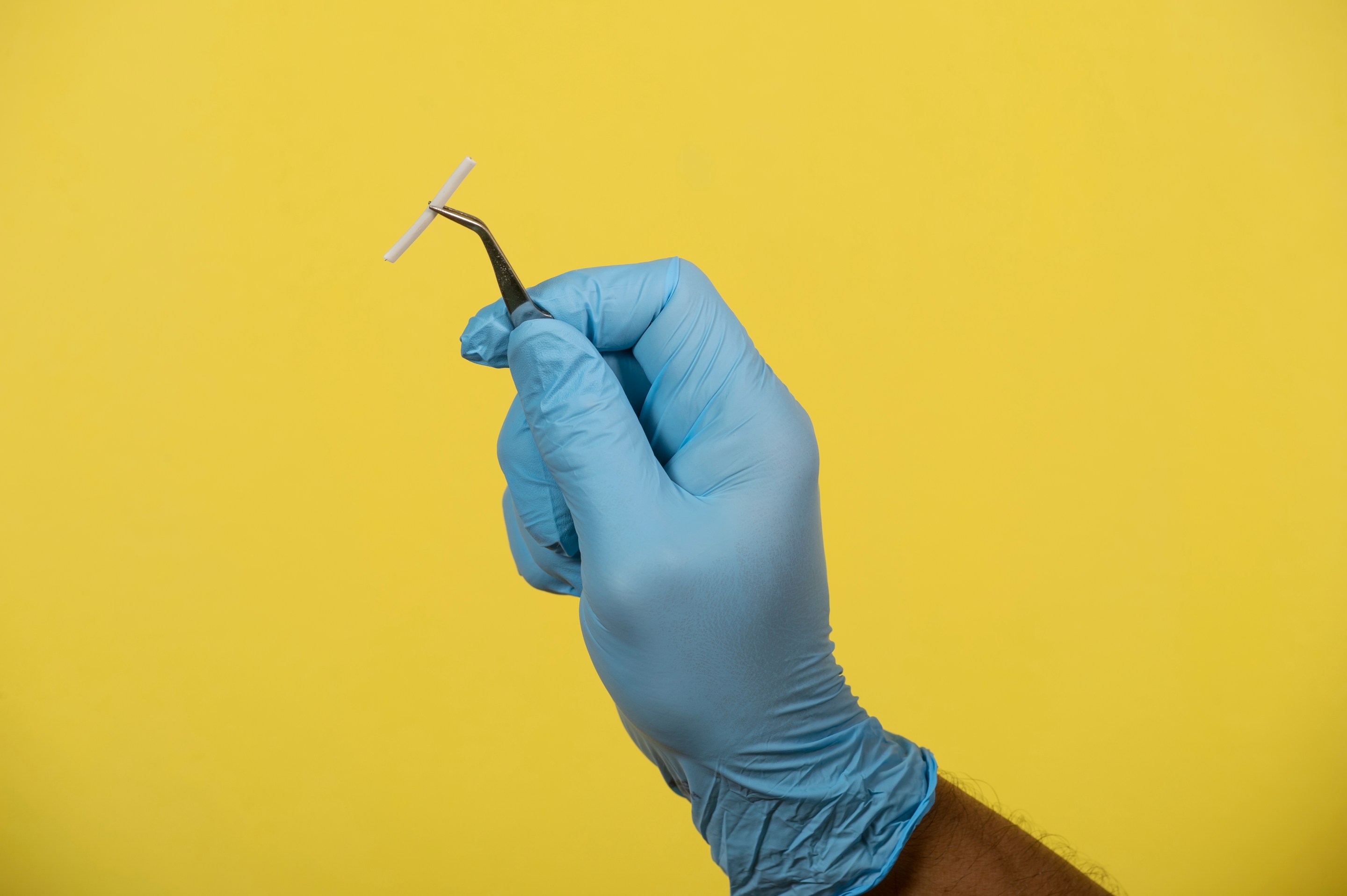 Hand wearing blue medical glove and holding gender-affirming hormonal transplant with tweezers.