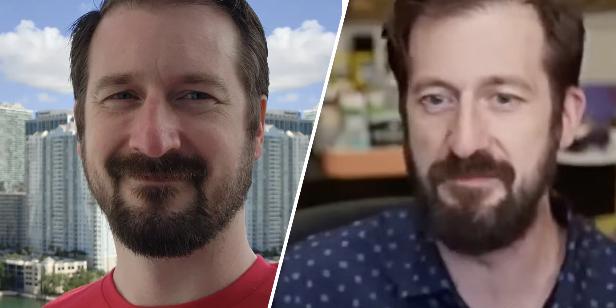 Nick Rekieta before and after