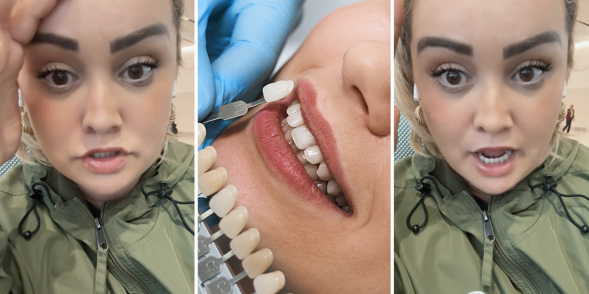 Woman talking(l+), Veneer tech sampling colors against mouth(c)
