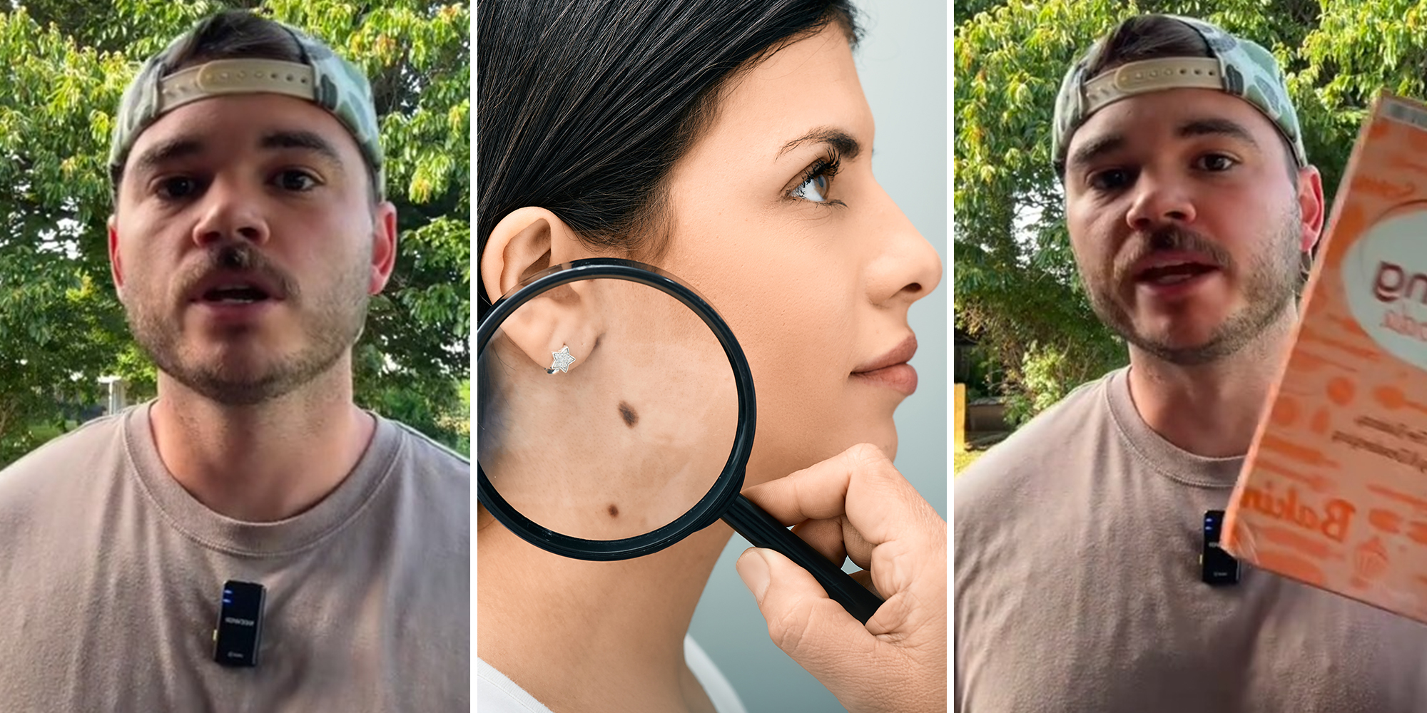 Expert shares how to get rid of moles with baking soda trick