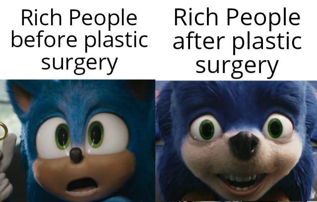 sonic before and after with caption "rich people before and after plastic surgery"