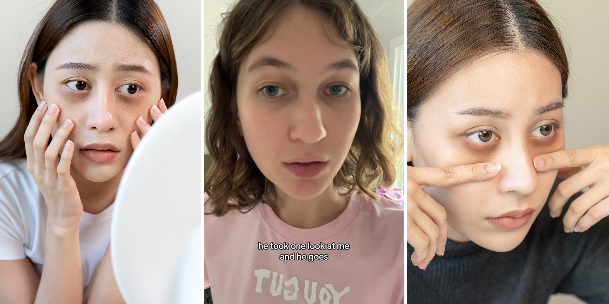 woman looking at mirror(l) woman explaining the causes of dark circles below eye(c) woman placing fingers on face to highlight dark eye circles(r)