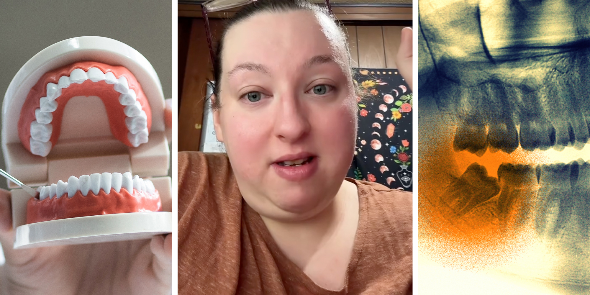 Dental model(l), Woman talking(c), Teeth x-ray(r)