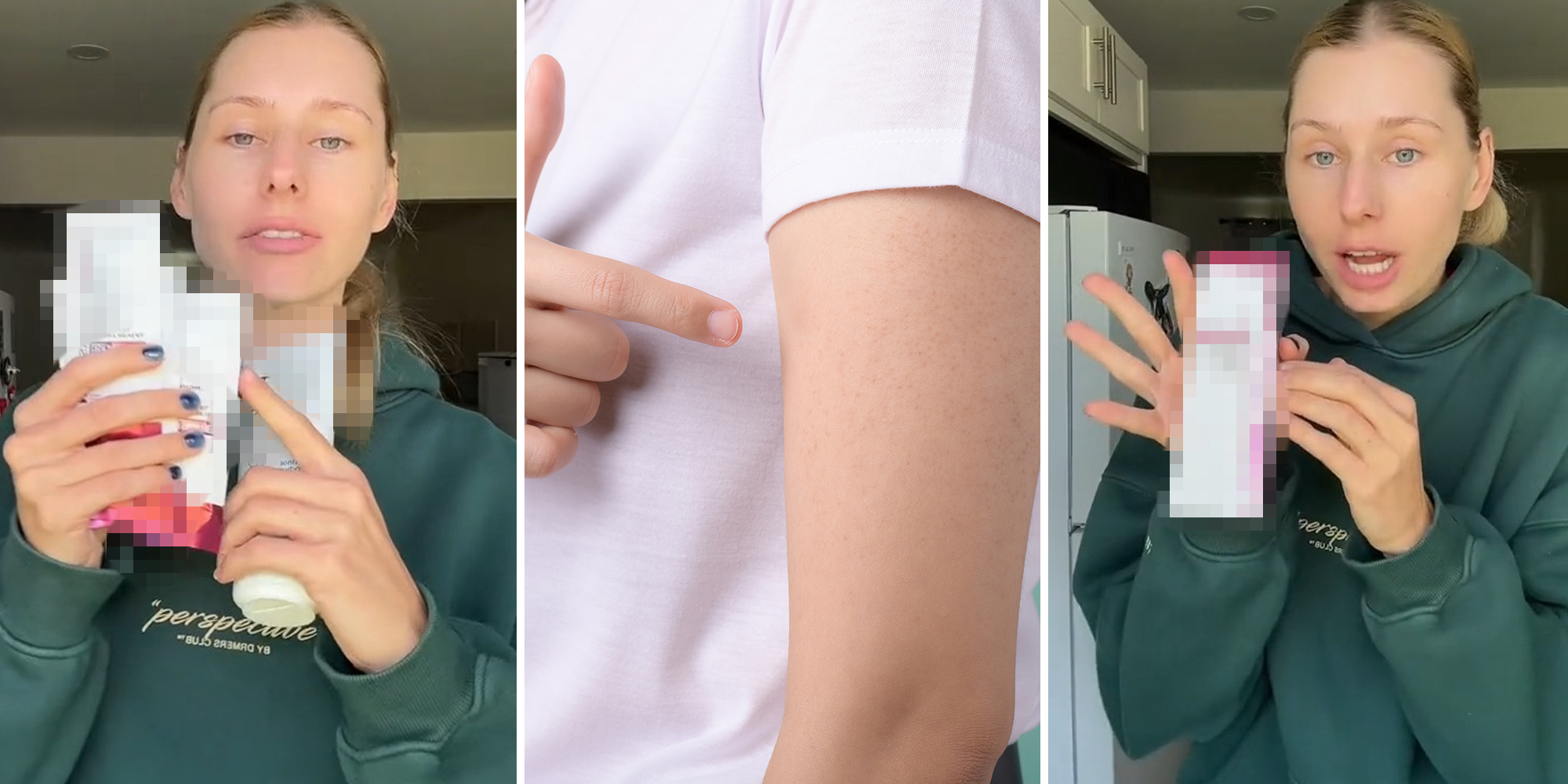 woman holding up blurred products(l) woman pointing at arm with red bumps(c) Woman holding up blurred Product(r)