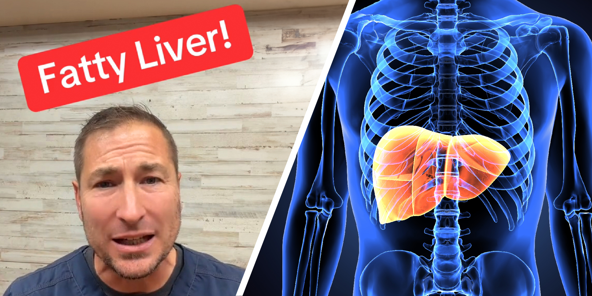 2 panel image. On the left a doctor speaks with the words "Fatty Liver!" over his head. On the right we see an see thru illustration showing a liver within a human body.