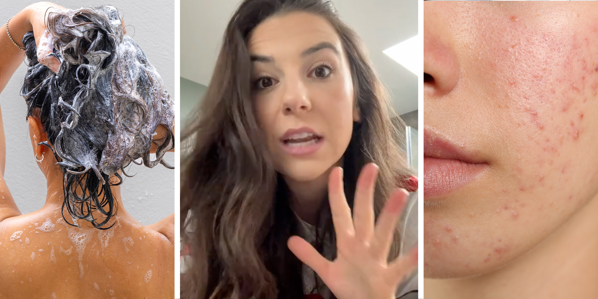 Someone shampooing hair(l), Woman talking(c), Face with acne(r)