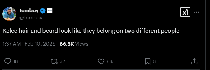 Screenshot from X post discussing travis kelce hair transplant