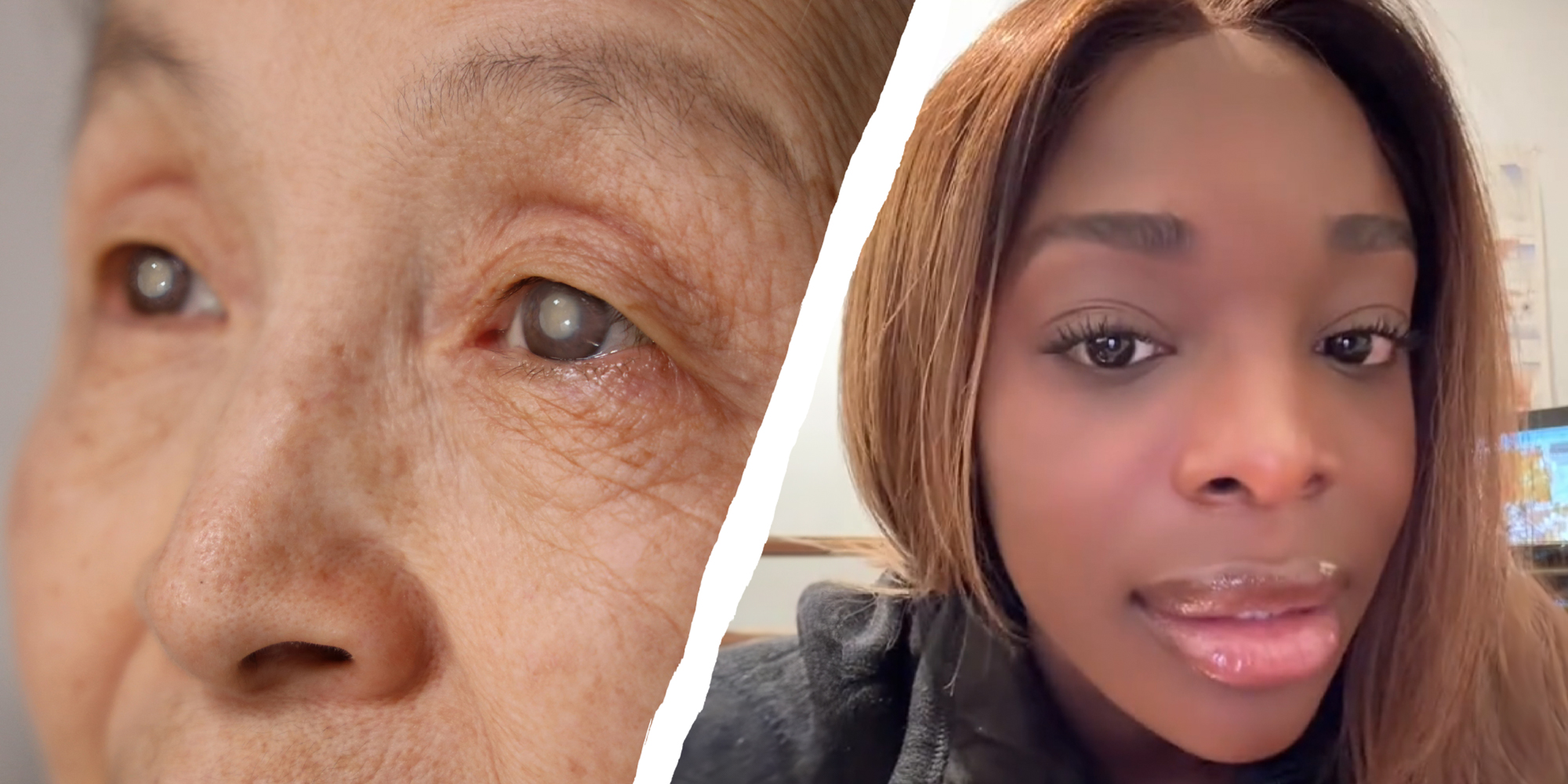 2 panel image: on the left is a close up of a person's eye, and on the right a person explains.