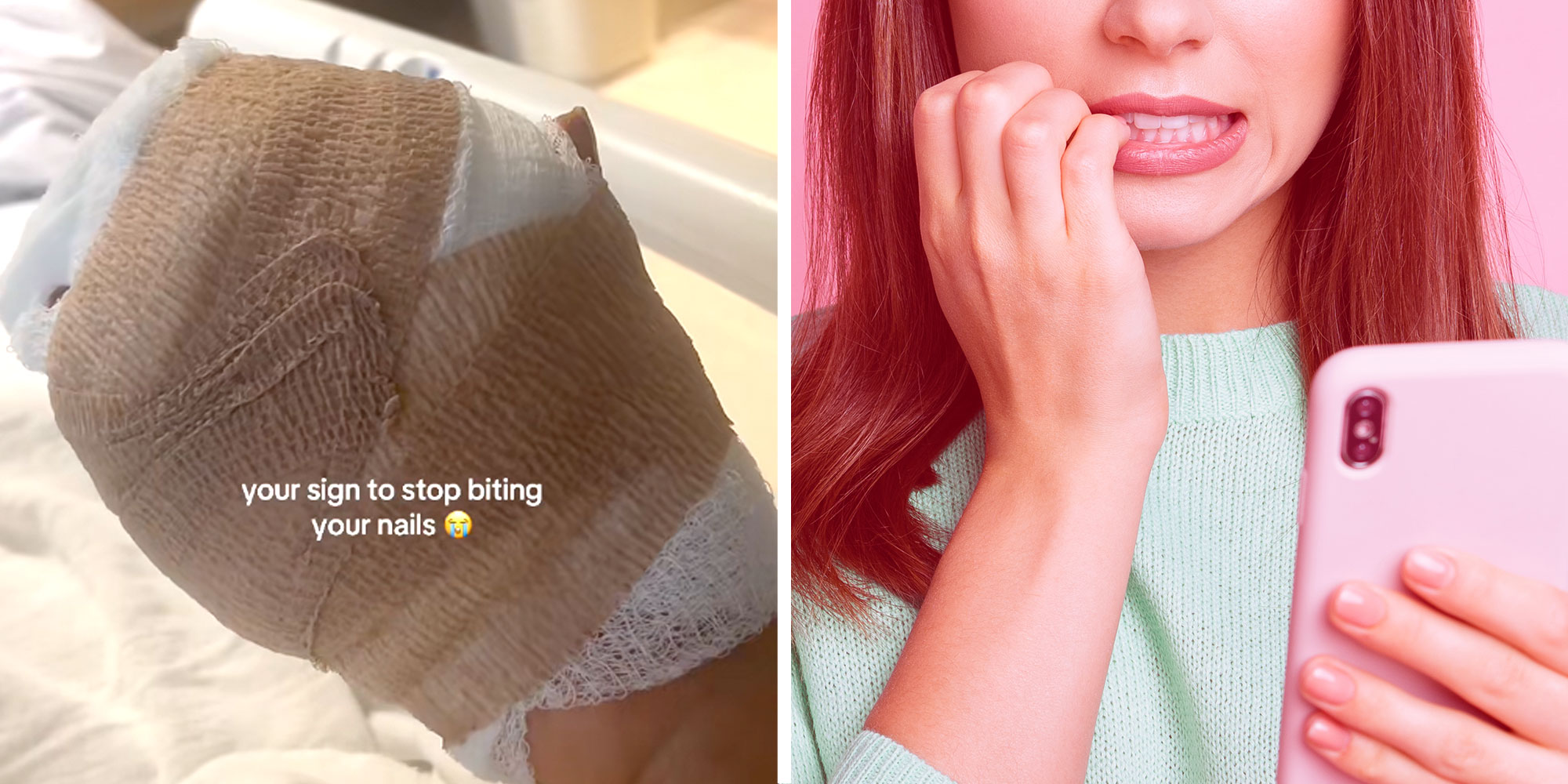 Screenshot of Tiktok user @breezzyy.yy's bandaged hand with the caption "your sign to stop biting your nails"; Photo of a woman holding a phone and biting her nails.