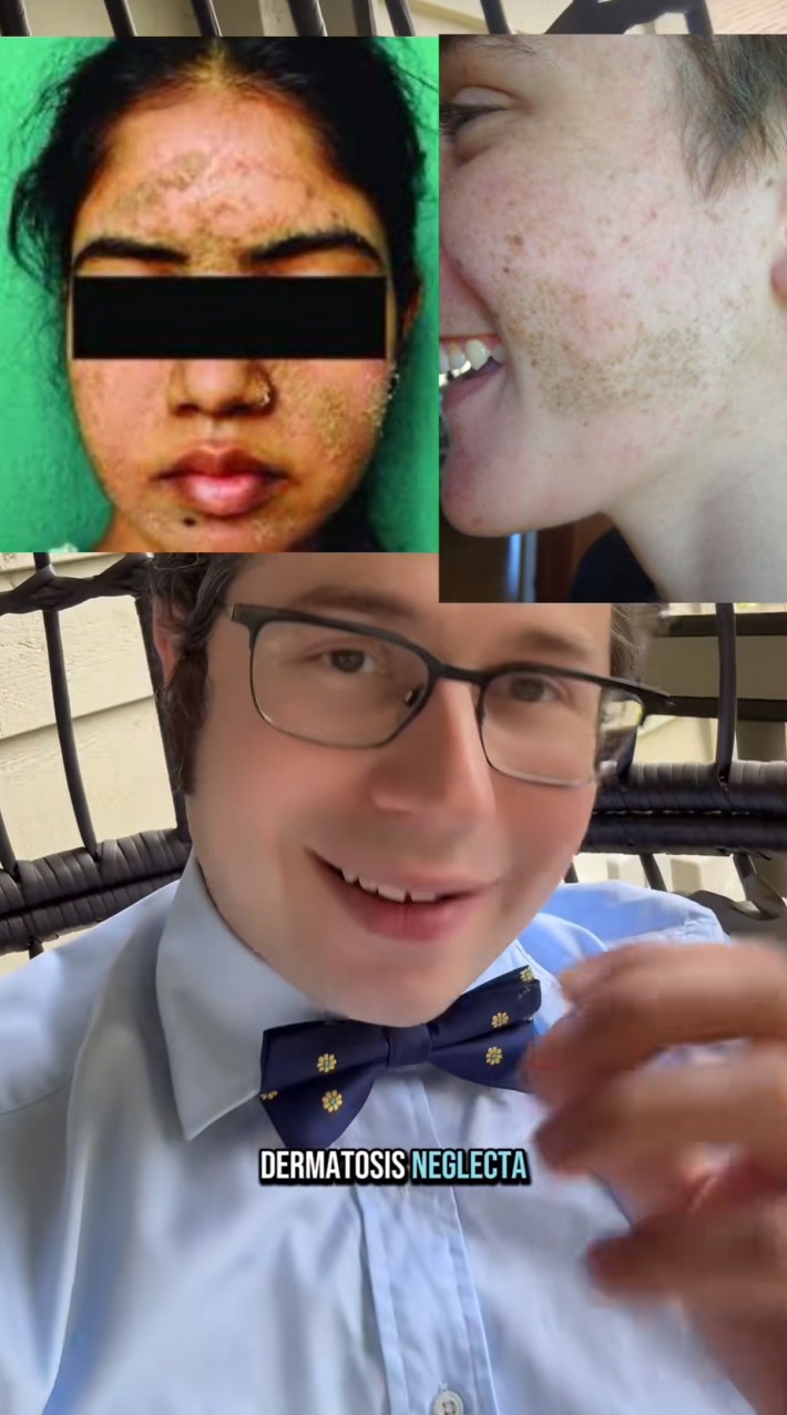 TikTok video of an allergist showing photos of people with dermatosis neglectica.