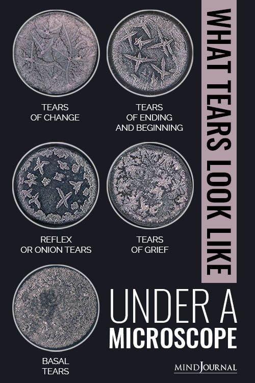 Photos of different types of tears under a microscope.