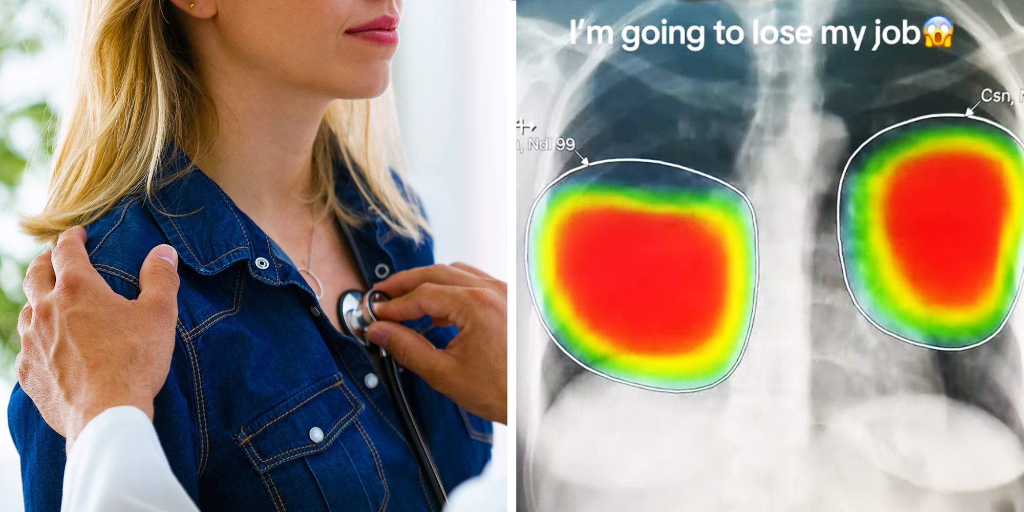 pulmonologist worries about AI