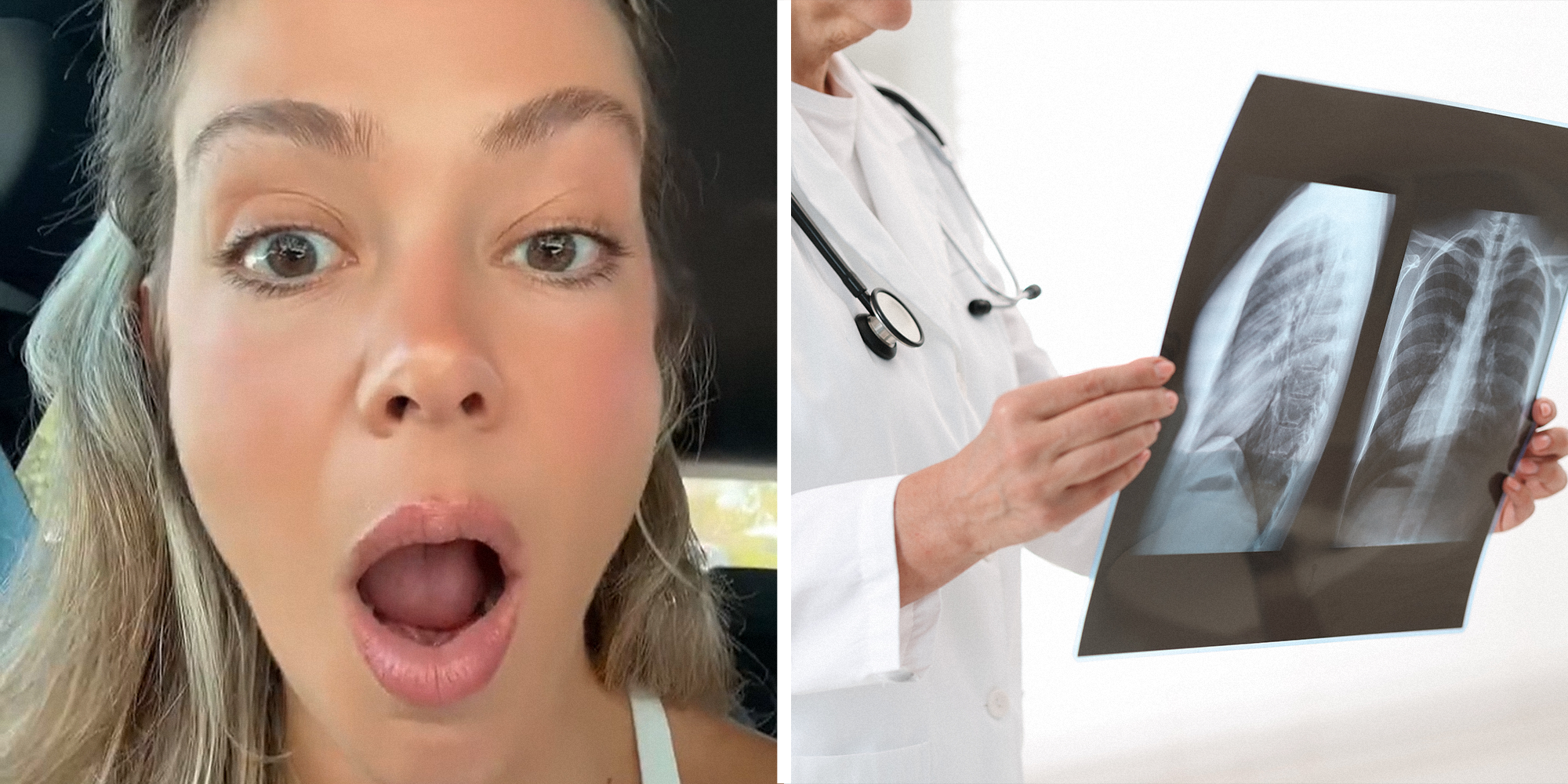 2 panel image. Woman with open mouth, looking shocked, on left. Doctor holding up x-ray on right.