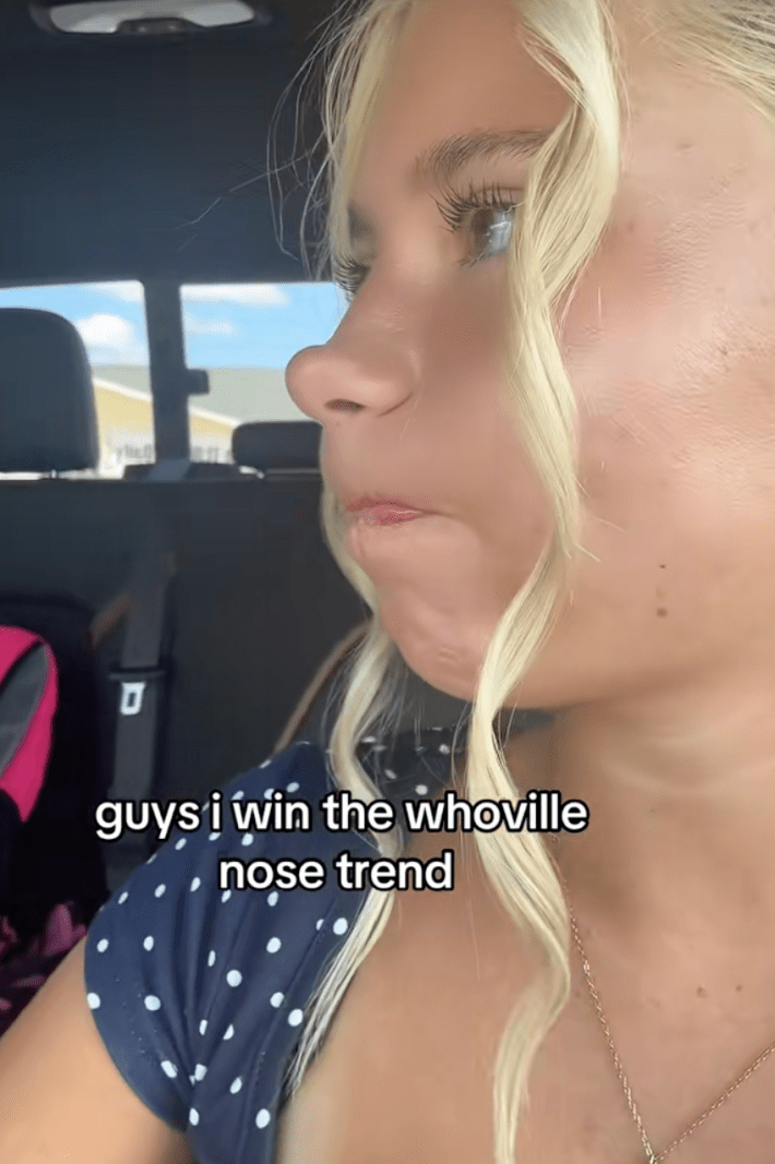 guys i win the whoville nose trend