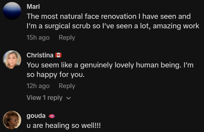 TikTok comments including one reading "The most natural face renovation I have seen and I’m a surgical scrub so I’ve seen a lot, amazing work"