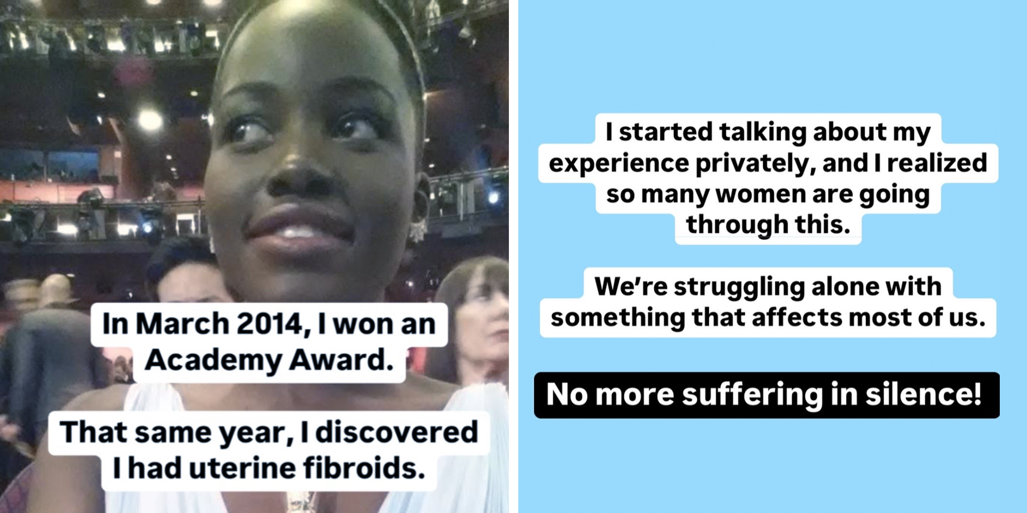 lupita nyongo fibroids