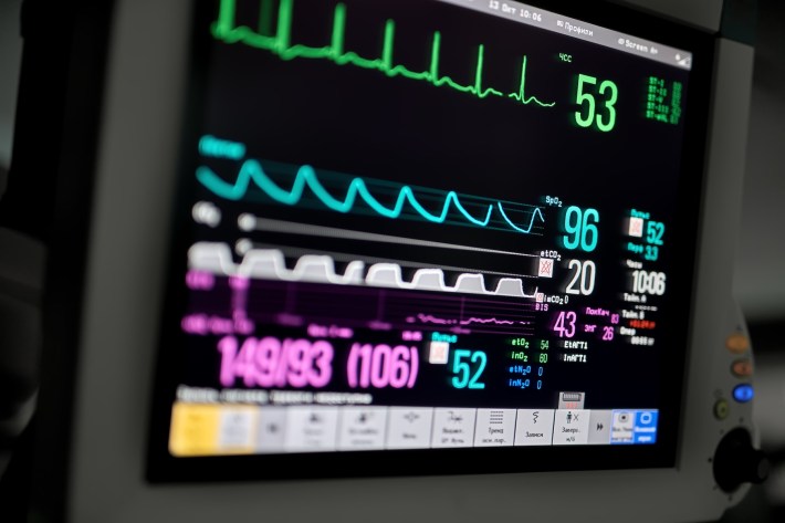 Closeup photo of an EKG monitor