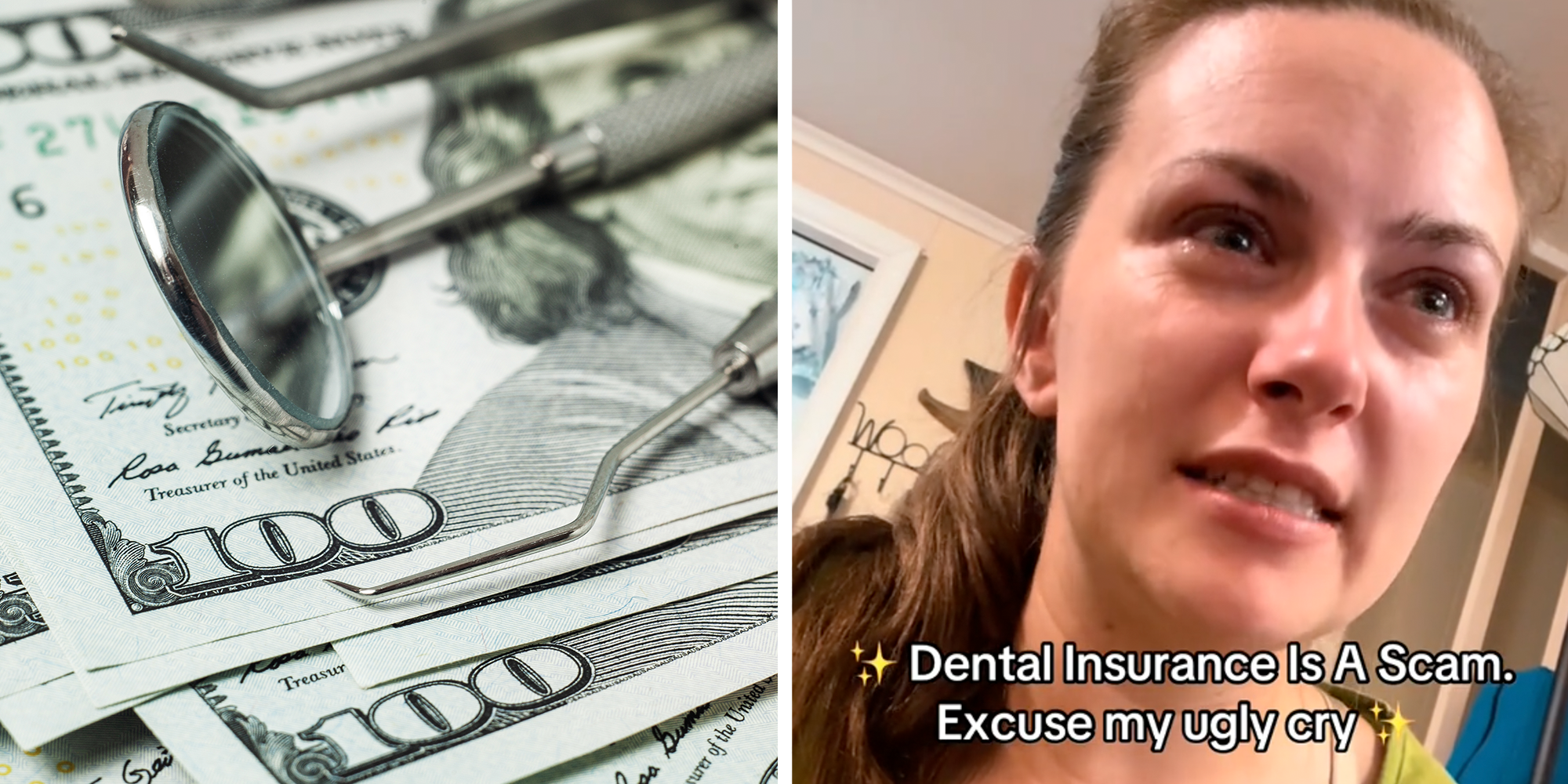 dental insurance wont pay for procedure