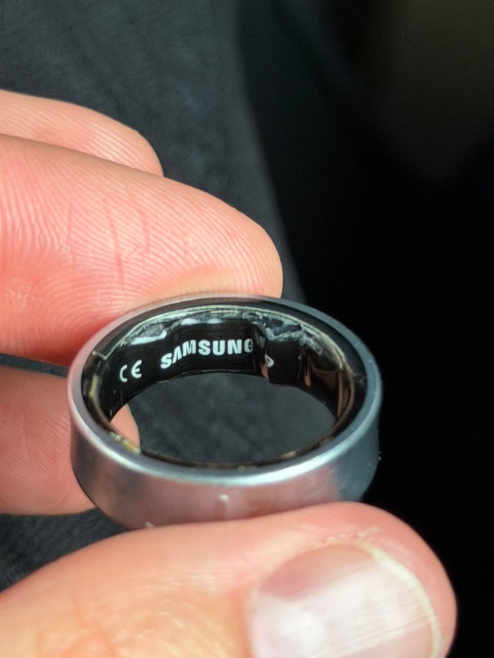 Photo of a swollen Samsung ring.