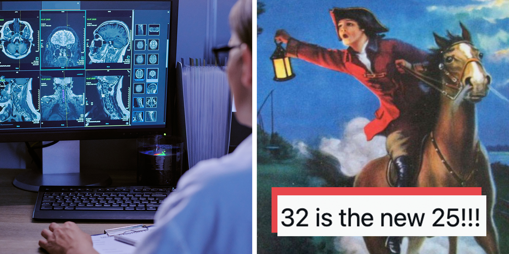 Left: Middle aged woman analyzing brain and spinal MRI scans on computer monitor in medical office. Right: Paul revere meme, text overlay reads, "32 is the new 25!!!"