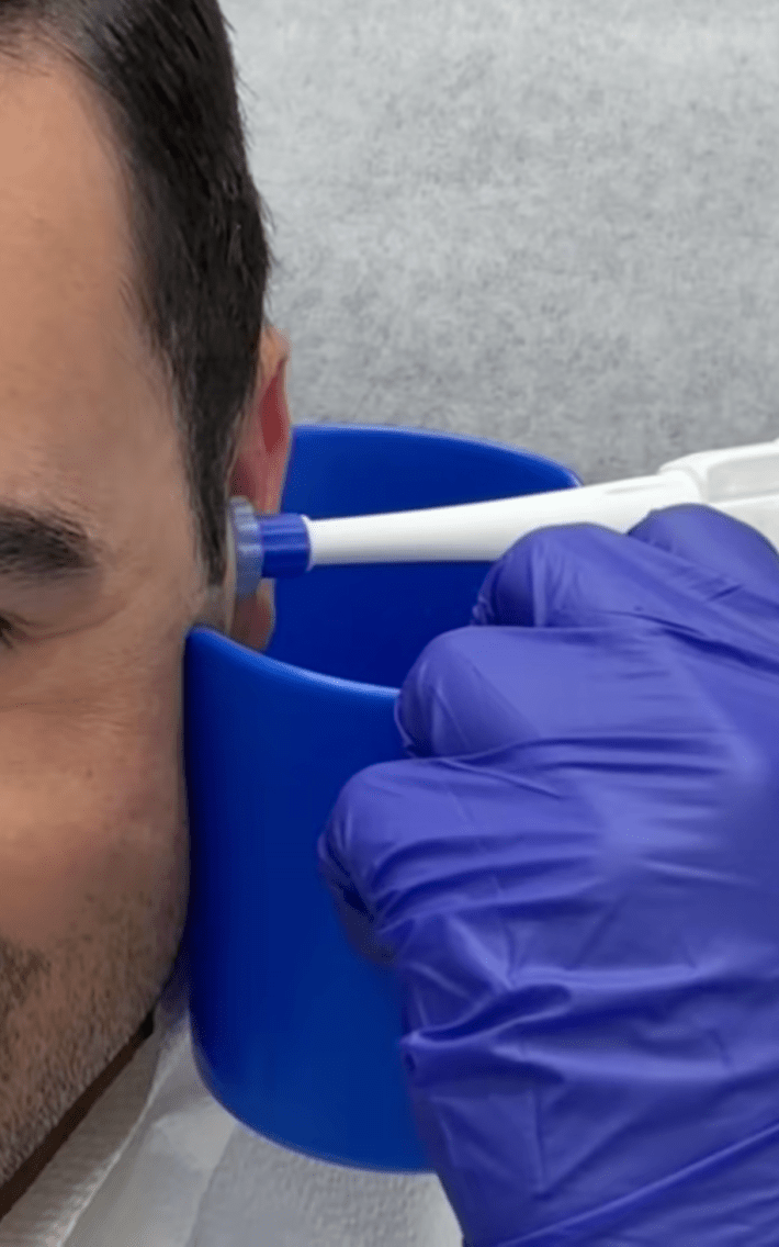 @javirod305 /TikTok heving earwax removal service at CVS MinuteClinic - healthcare provider uses device to remove ear wax with warm water