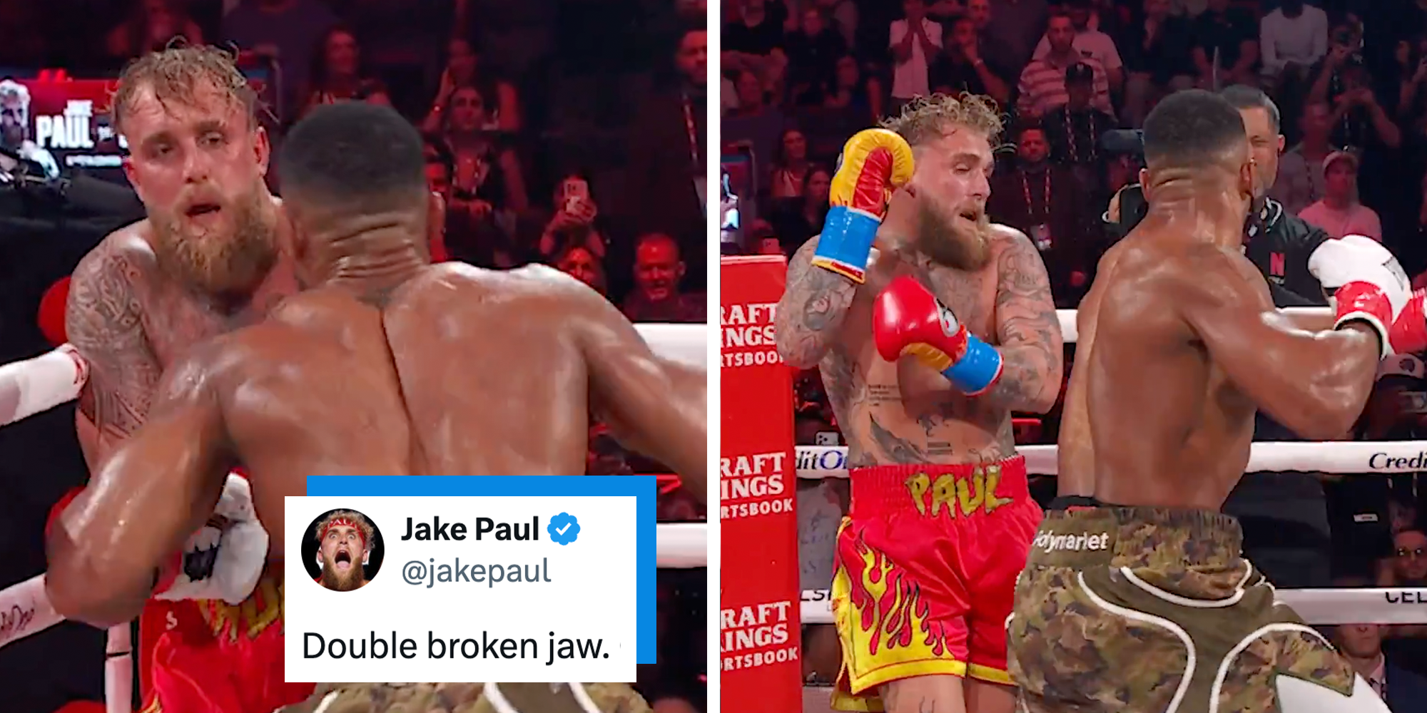 jake paul broken jaw netflix