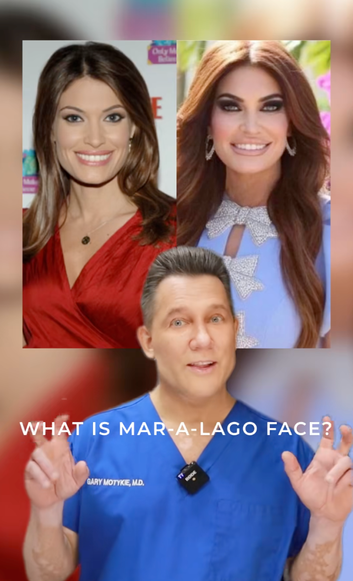 Plastic surgeon showing a before and after of a woman who has "Mar a Lago face."