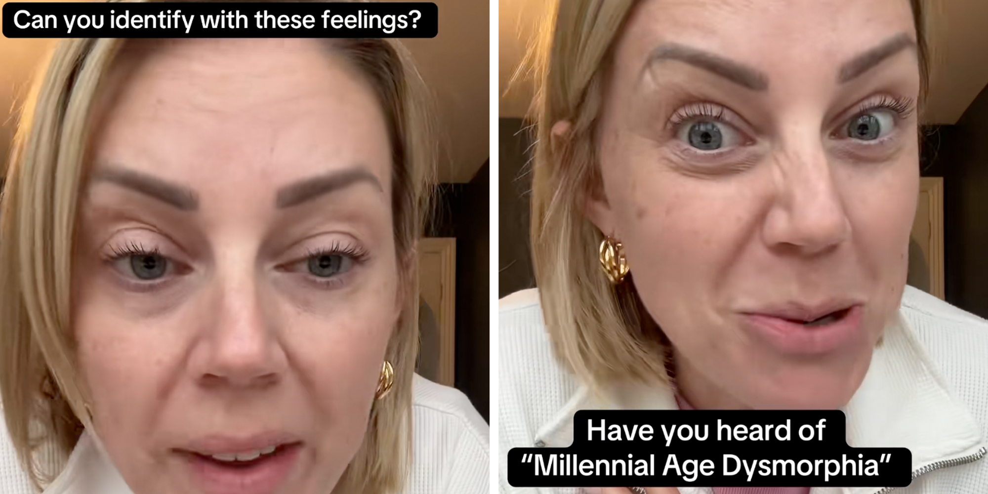 Blonde woman looking into the camera, text overlay reads, "Have you heard of 'millennial age dysmorphia?'"