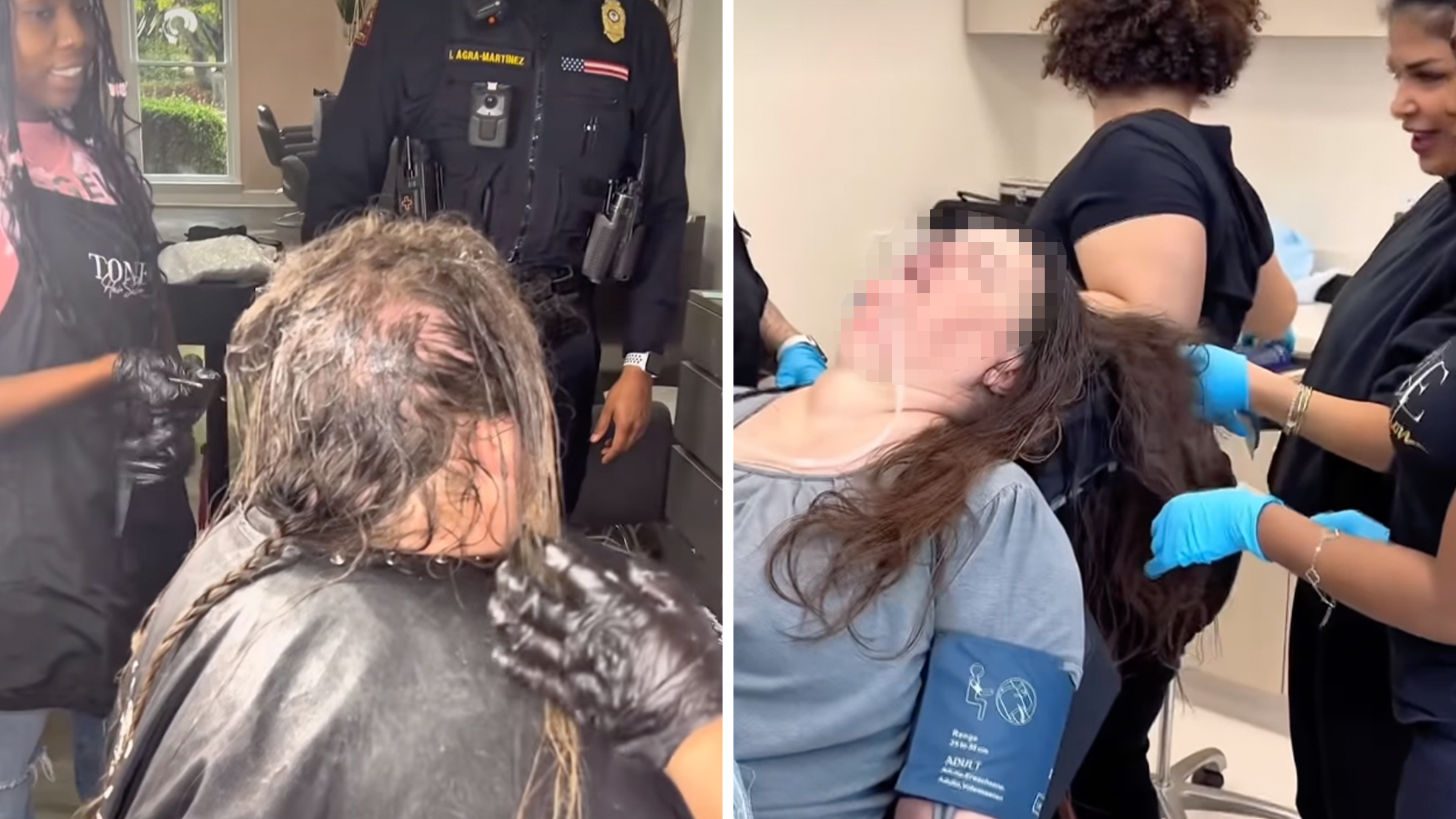 sedation dematting service hair tangled