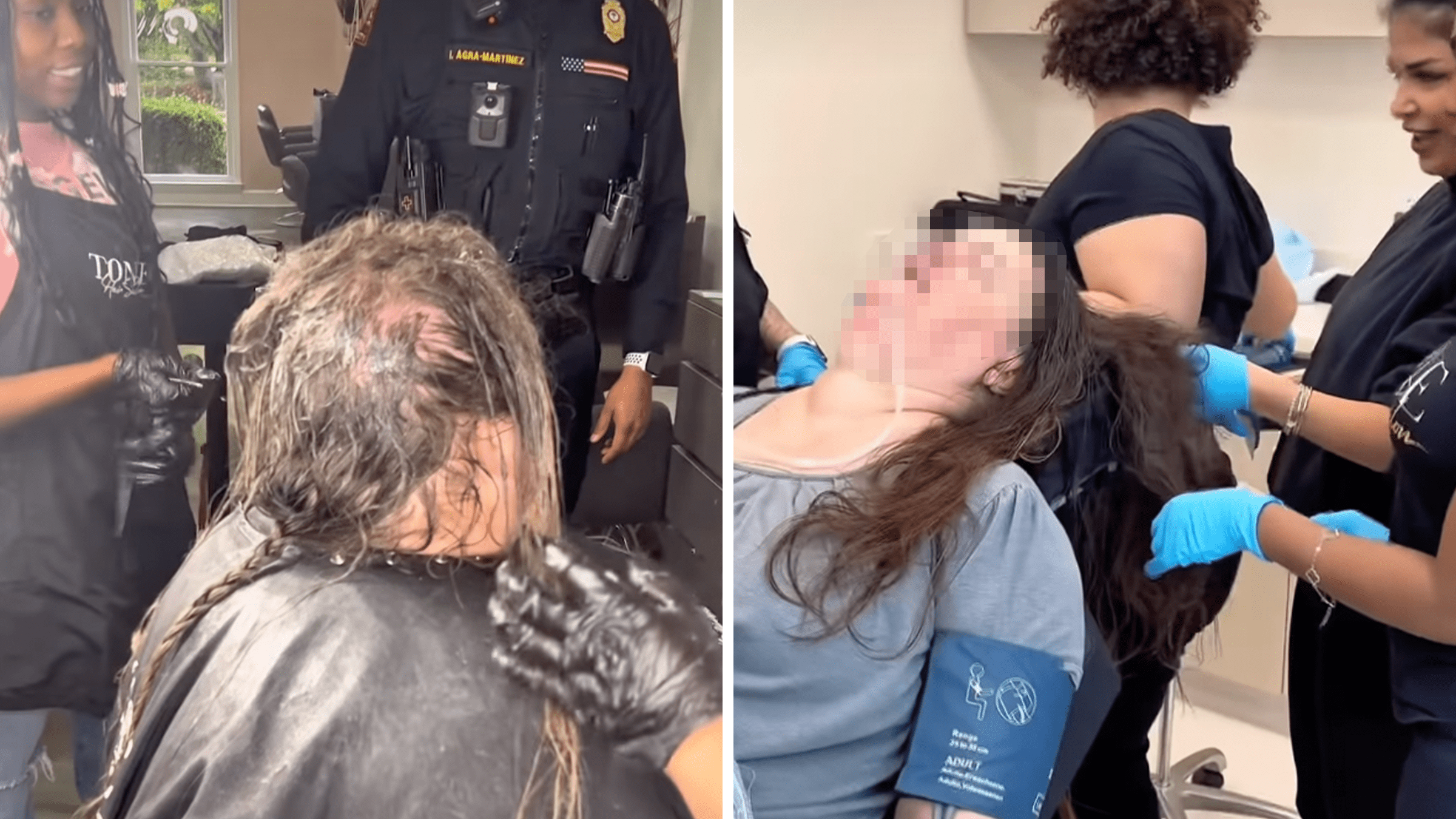 sedation dematting service hair tangled