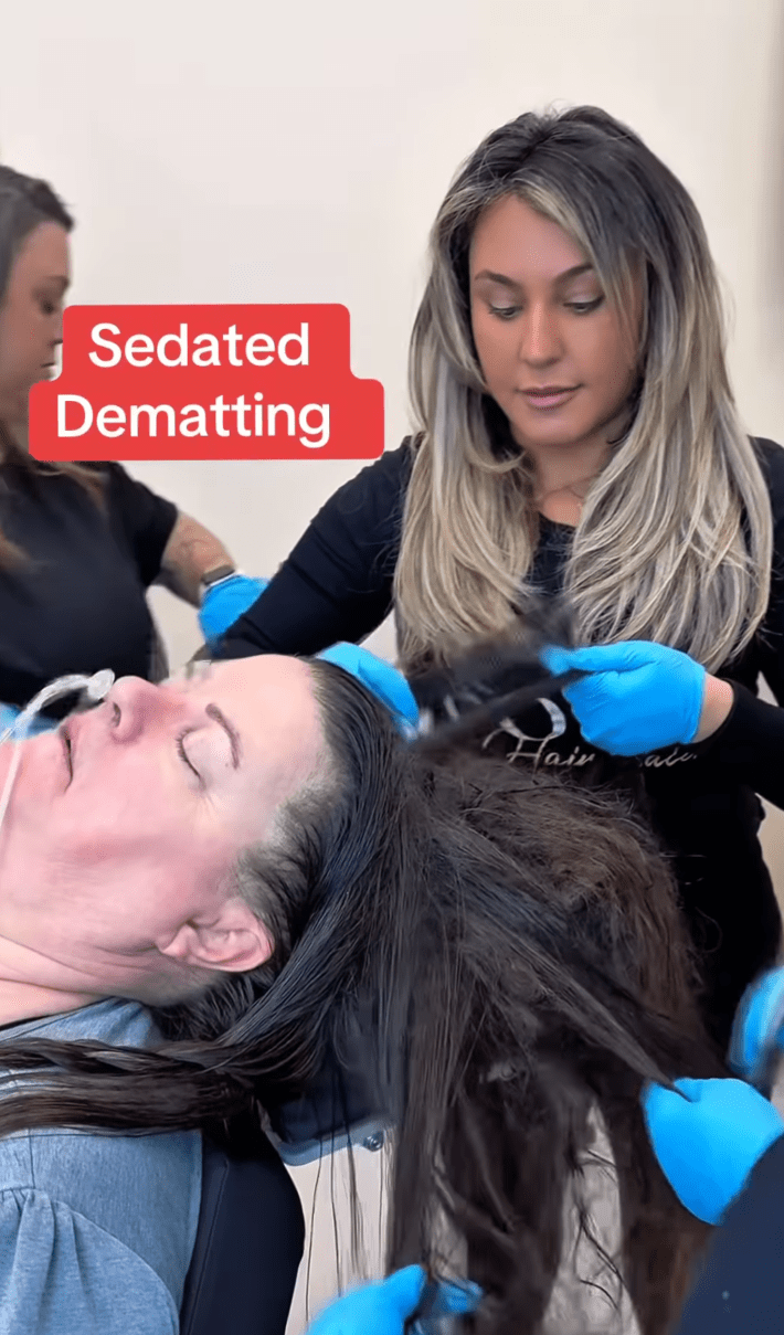 @ledafazal/Instagram team of hair stylists performing sedated dematting