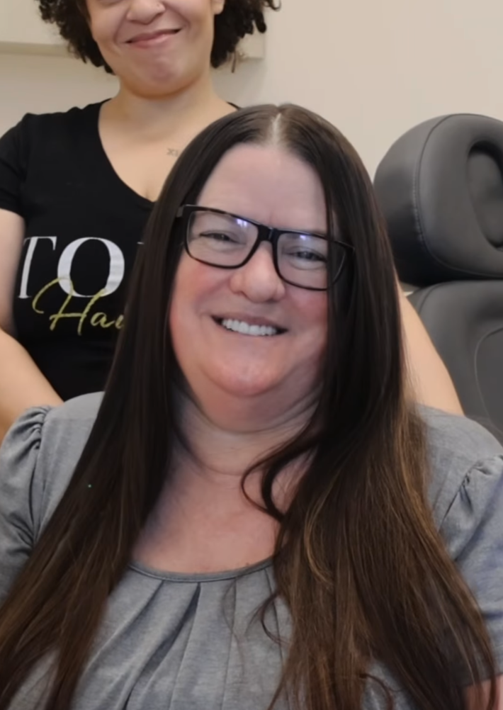 @ledafazal/Instagram transformation to smooth hair after sedated dematting