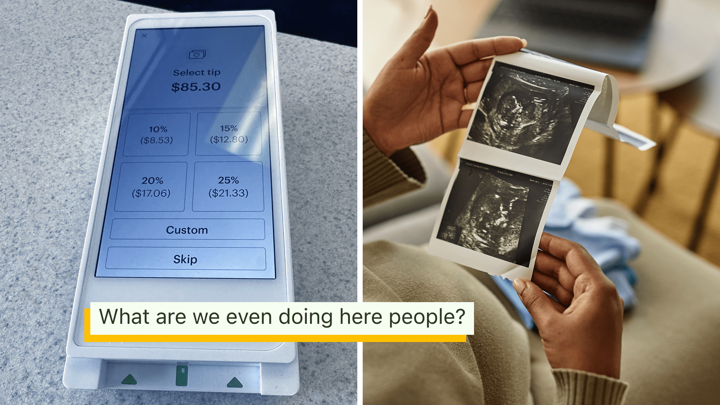 pay portal with tip requested next to sonogram print-outs