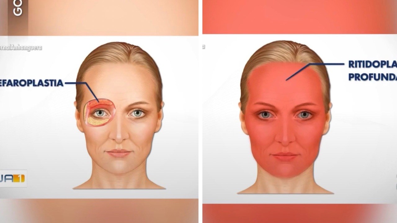Woman Dies After Six Cosmetic Procedures