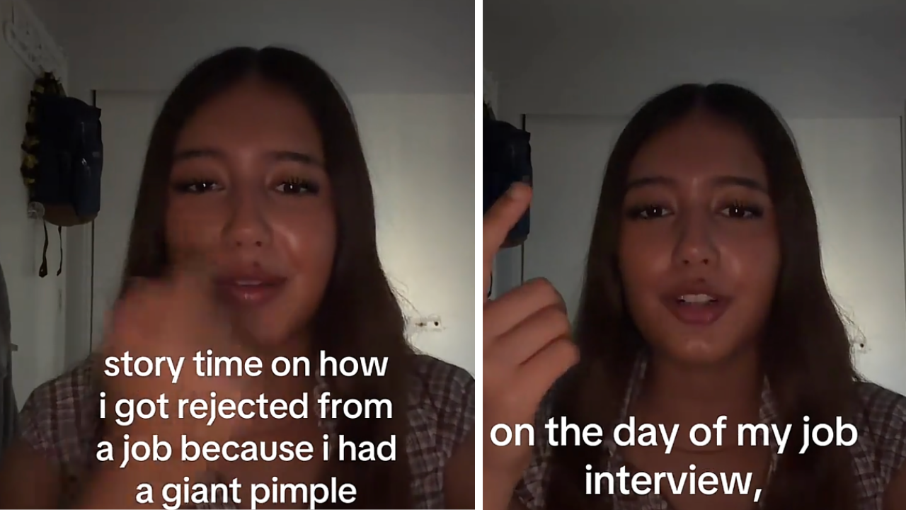 Woman Says She Was Rejected for a Job After Interview Because of a Pimple: ‘We Take Pride in Appearance’