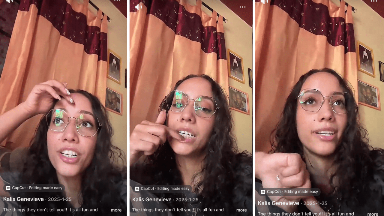 Woman Shares What Happens After Getting Braces Removed