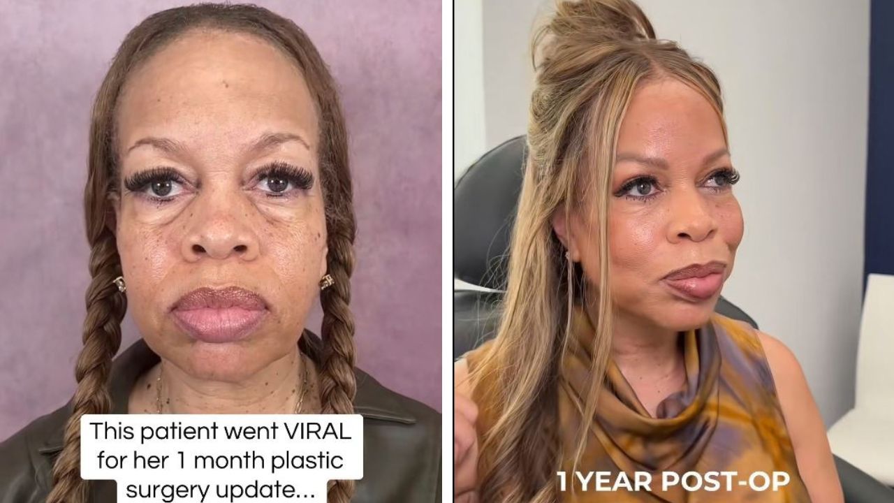Surgeon shares before and after op pictures of an old patient.