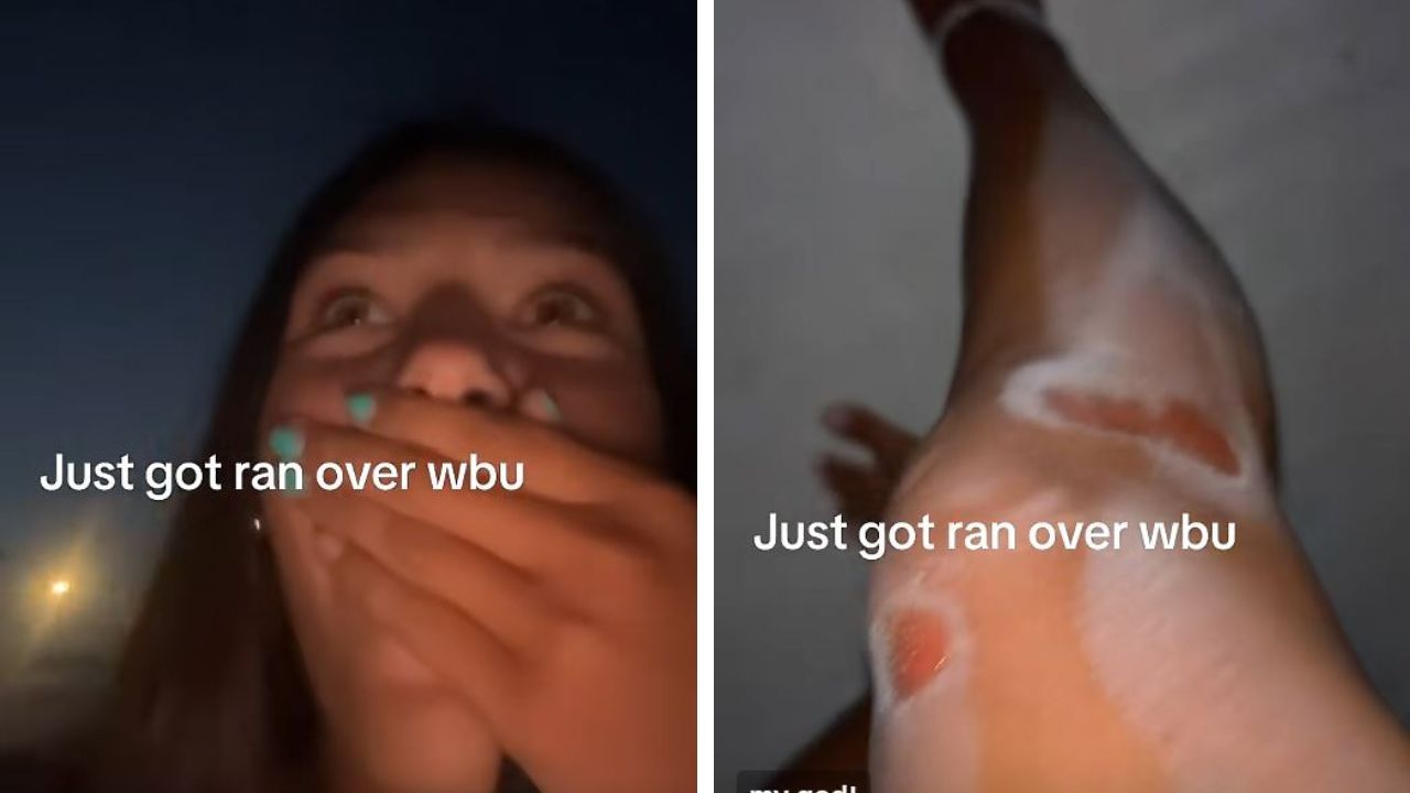TikToker gets injured by car.
