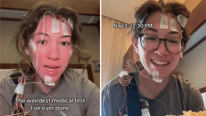 TikToker Does a Medical Test to Diagnose Why She Takes Multiple Naps a Day, Even After a Full Night's Rest